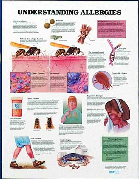 Understand Allergies Wall Chart | HCE