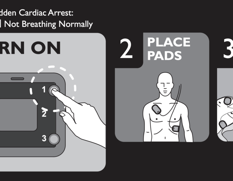 Setting Up Philips Heartstart 